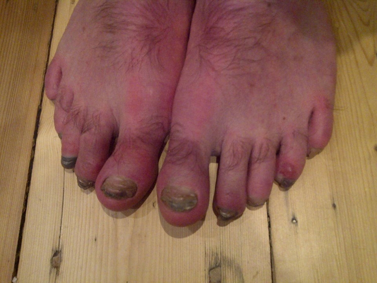 Gav's feet